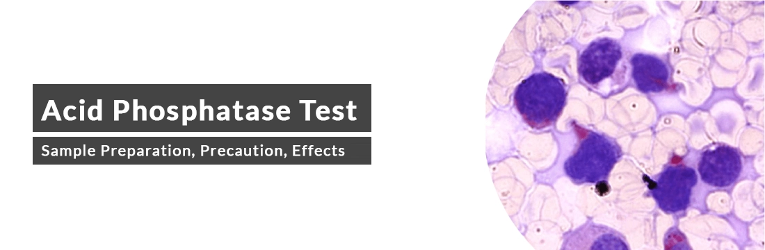 Acid Phosphatase Test: Sample Preparation, Precaution, Effects